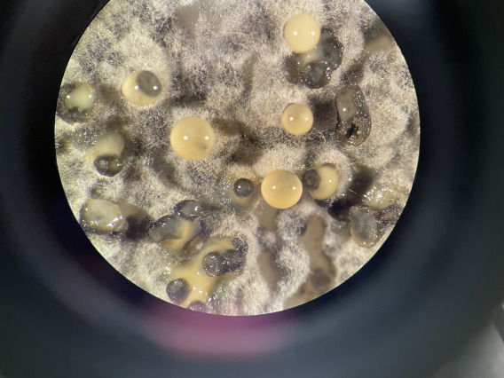 Microscope image of bacteria