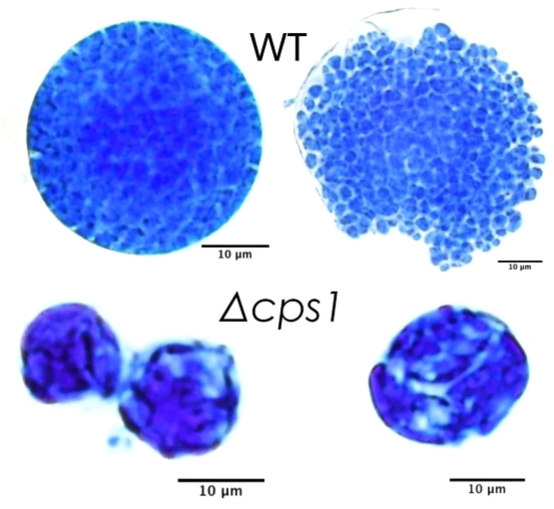 Morphology of spherules (left) and endospore release (right) of the wild-type and a CPS1 deletion mutant of Coccidioides.