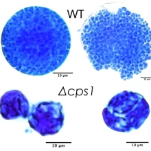 Morphology of spherules (left) and endospore release (right) of the wild-type and a CPS1 deletion mutant of Coccidioides.